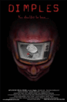Dimples