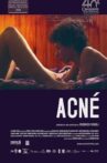 Acne Movie Streaming Online