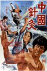 Chinese Kung Fu and Acupuncture Movie Streaming Online