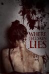 Where the Skin Lies Movie Streaming Online