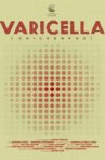 Varicella Movie Streaming Online