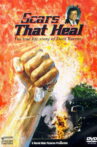 Scars That Heal: The Dave Roever Story Movie Streaming Online