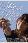 Skin and Blister Movie Streaming Online